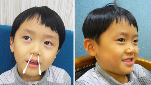 침치료