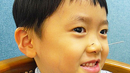 침치료